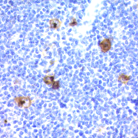 CD15 / FUT4; Clone Leu-M1 (Concentrate)